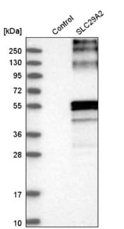 ENT2 Antibody, Novus Biologicals 25 &mu;L; Unlabeled:Anticorps, Polyclonal